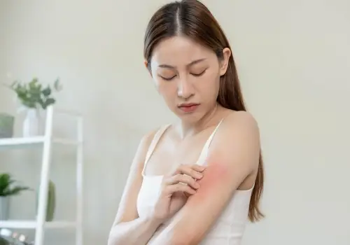 best skin problems treatment in jayanagar bangalore